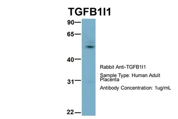 TGFB1I1 Rabbit Polyclonal Antibody