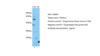 TGFB1I1 Rabbit Polyclonal Antibody