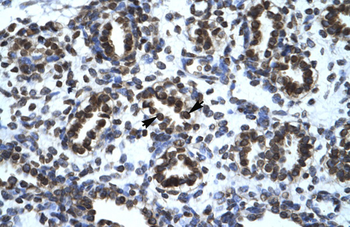 TGFB1I1 Rabbit Polyclonal Antibody