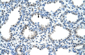 PIR Rabbit Polyclonal Antibody