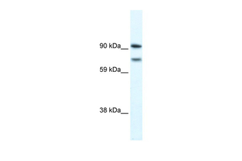 ZFHX1B Rabbit Polyclonal Antibody