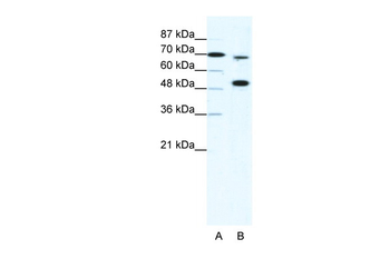 MLL4 Rabbit Polyclonal Antibody