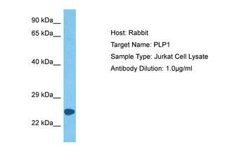 PLP1 Rabbit Polyclonal Antibody