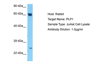 PLP1 Rabbit Polyclonal Antibody
