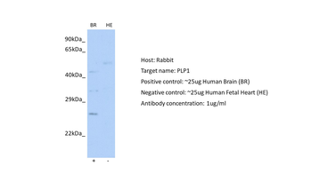 PLP1 Rabbit Polyclonal Antibody