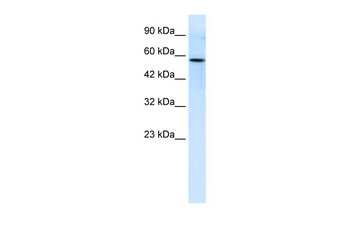 RIPX Rabbit Polyclonal Antibody