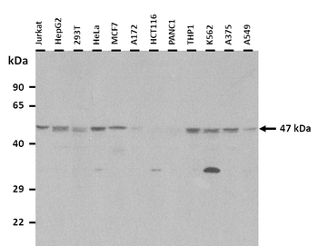 ELK4 Rabbit Polyclonal Antibody