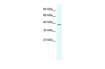 ELK4 Rabbit Polyclonal Antibody