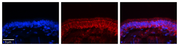 RTRAF Rabbit Polyclonal Antibody