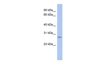 RTRAF Rabbit Polyclonal Antibody