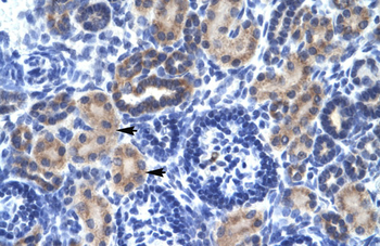 RNF141 Rabbit Polyclonal Antibody