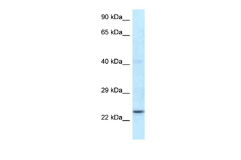 Rnf141 Rabbit Polyclonal Antibody