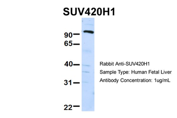KMT5B Rabbit Polyclonal Antibody