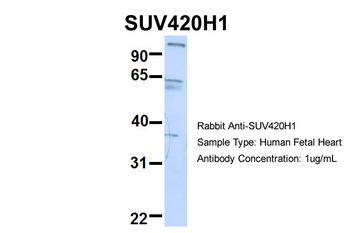 KMT5B Rabbit Polyclonal Antibody