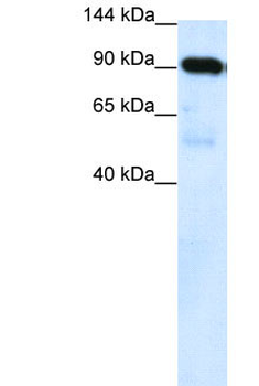 KMT5B Rabbit Polyclonal Antibody