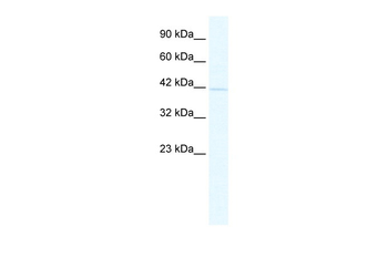 BTBD14B Rabbit Polyclonal Antibody