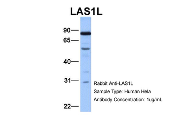 LAS1L Rabbit Polyclonal Antibody