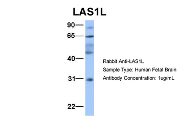 LAS1L Rabbit Polyclonal Antibody