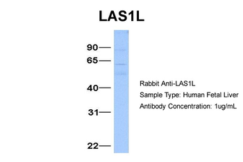 LAS1L Rabbit Polyclonal Antibody