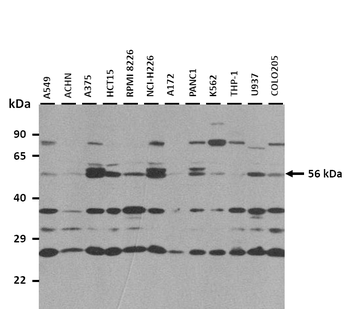 SLC18A1 Rabbit Polyclonal Antibody
