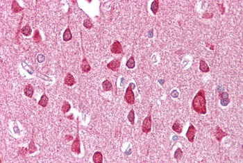 SLC18A1 Rabbit Polyclonal Antibody