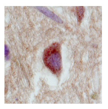 SLC18A1 Rabbit Polyclonal Antibody