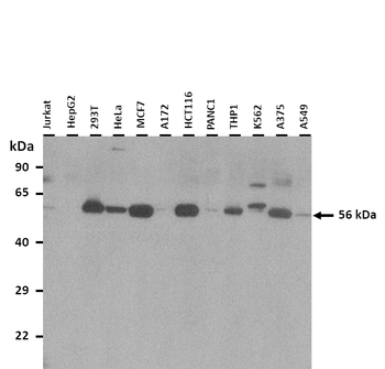 SLC18A1 Rabbit Polyclonal Antibody