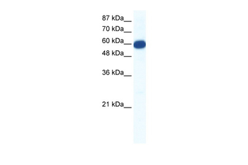 SLC18A1 Rabbit Polyclonal Antibody