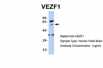 VEZF1 Rabbit Polyclonal Antibody
