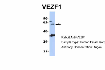 VEZF1 Rabbit Polyclonal Antibody