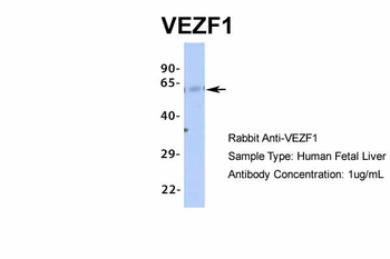 VEZF1 Rabbit Polyclonal Antibody