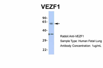 VEZF1 Rabbit Polyclonal Antibody