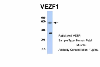 VEZF1 Rabbit Polyclonal Antibody