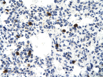 VEZF1 Rabbit Polyclonal Antibody