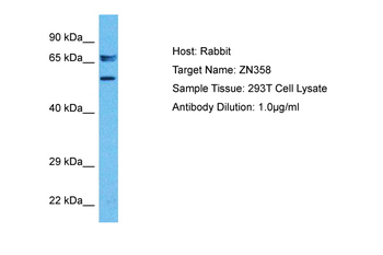 ZNF358 Rabbit Polyclonal Antibody