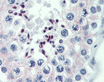 PRDM9 Rabbit Polyclonal Antibody