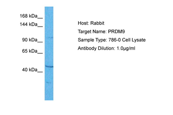 PRDM9 Rabbit Polyclonal Antibody