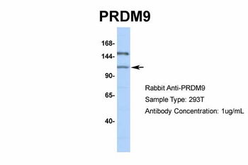 PRDM9 Rabbit Polyclonal Antibody
