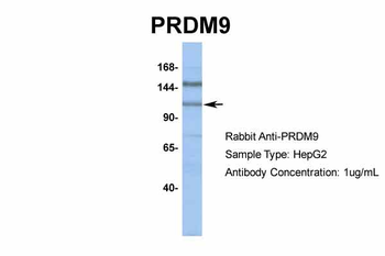 PRDM9 Rabbit Polyclonal Antibody
