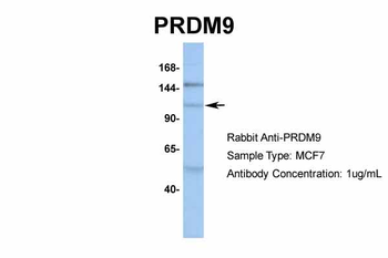 PRDM9 Rabbit Polyclonal Antibody