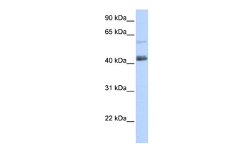 PRDM15 Rabbit Polyclonal Antibody