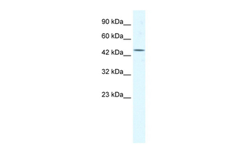 DDX48 Rabbit Polyclonal Antibody