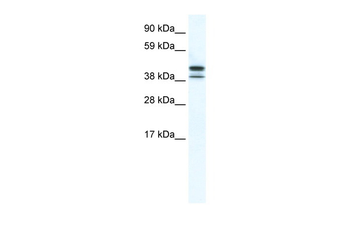 TRF3 Rabbit Polyclonal Antibody