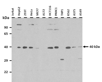 EN1 Rabbit Polyclonal Antibody