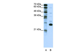 RCV1 Rabbit Polyclonal Antibody