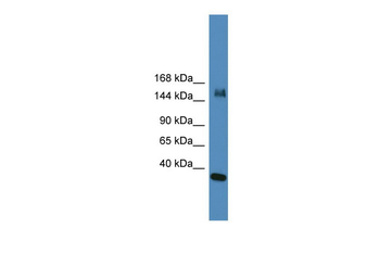 UTX Rabbit Polyclonal Antibody