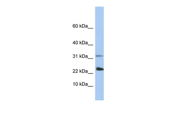 EXOSC3 Rabbit Polyclonal Antibody