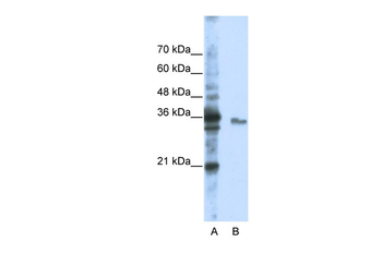 EXOSC3 Rabbit Polyclonal Antibody