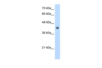 KYAT3 Rabbit Polyclonal Antibody
