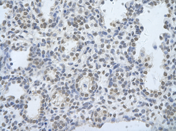 CUGBP2 Rabbit Polyclonal Antibody